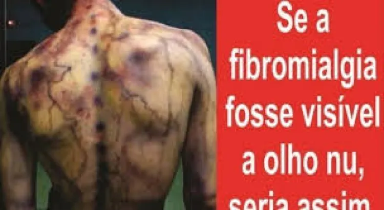Imagem ilustrativa 
